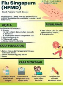 Flu Singapura (HFMD)