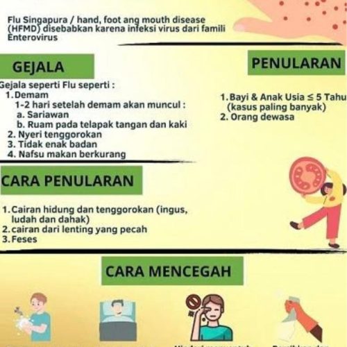 Flu Singapura (HFMD)